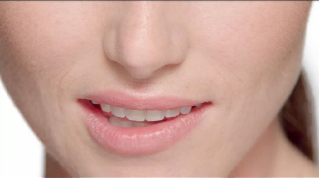 Veneers & smile design